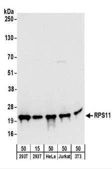 RPS11 / Ribosomal Protein 11 Antibody - Detection of Human and Mouse RPS11 by Western Blot. Samples: Whole cell lysate from 293T (15 and 50 ug), HeLa (50 ug), Jurkat (50 ug), and mouse NIH3T3 (50 ug) cells. Antibodies: Affinity purified rabbit anti-RPS11 antibody used for WB at 0.1 ug/ml. Detection: Chemiluminescence with an exposure time of 10 seconds.