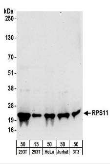 RPS11 / Ribosomal Protein 11 Antibody - Detection of Human and Mouse RPS11 by Western Blot. Samples: Whole cell lysate from 293T (15 and 50 ug), HeLa (50 ug), Jurkat (50 ug), and mouse NIH3T3 (50 ug) cells. Antibodies: Affinity purified rabbit anti-RPS11 antibody used for WB at 0.1 ug/ml. Detection: Chemiluminescence with an exposure time of 30 seconds.