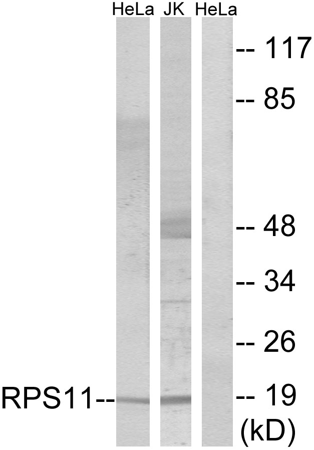 RPS11 / Ribosomal Protein 11 Antibody - Western blot analysis of lysates from HeLa and Jurkat cells, using RPS11 Antibody. The lane on the right is blocked with the synthesized peptide.