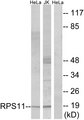 RPS11 / Ribosomal Protein 11 Antibody - Western blot analysis of lysates from HeLa and Jurkat cells, using RPS11 Antibody. The lane on the right is blocked with the synthesized peptide.