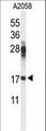 RPS11 / Ribosomal Protein 11 Antibody - Western blot of RPS11 Antibody in A2058 cell line lysates (35 ug/lane). RPS11 (arrow) was detected using the purified antibody.