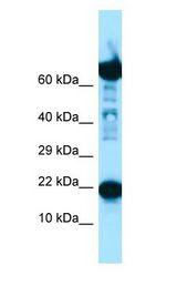 RPS11 / Ribosomal Protein 11 Antibody - RPS11 antibody Western Blot of Fetal Lung.  This image was taken for the unconjugated form of this product. Other forms have not been tested.