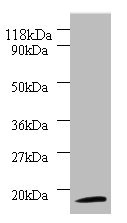 RPS11 / Ribosomal Protein 11 Antibody - Western blot All lanes: 40S ribosomal protein S11 antibody at 2µg/ml + 293T whole cell lysate Secondary Goat polyclonal to rabbit IgG at 1/10000 dilution Predicted band size: 18 kDa Observed band size: 18 kDa