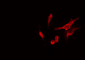 RPS11 / Ribosomal Protein 11 Antibody - Staining HeLa cells by IF/ICC. The samples were fixed with PFA and permeabilized in 0.1% Triton X-100, then blocked in 10% serum for 45 min at 25°C. The primary antibody was diluted at 1:200 and incubated with the sample for 1 hour at 37°C. An Alexa Fluor 594 conjugated goat anti-rabbit IgG (H+L) antibody, diluted at 1/600, was used as secondary antibody.