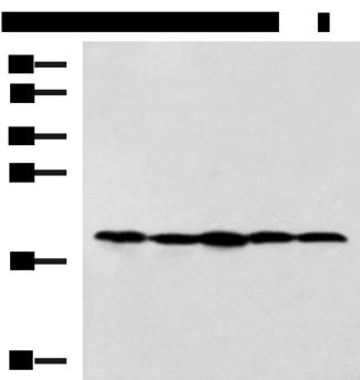 RPS11 / Ribosomal Protein 11 Antibody - Western blot analysis of Jurkat NIH/3T3 Raji 231 and A172 cell lysates  using RPS11 Polyclonal Antibody at dilution of 1:700