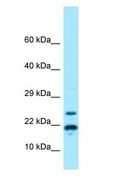 RPS11 / Ribosomal Protein 11 Antibody - RPS11 antibody Western Blot of MCF7.  This image was taken for the unconjugated form of this product. Other forms have not been tested.
