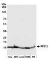 RPS12 / Ribosomal Protein S12 Antibody - Detection of human and mouse RPS12 by western blot. Samples: Whole cell lysate (50 µg) from HeLa, HEK293T, Jurkat, mouse TCMK-1, and mouse NIH 3T3 cells prepared using NETN lysis buffer. Antibody: Affinity purified rabbit anti-RPS12 antibody used for WB at 0.04 µg/ml. Detection: Chemiluminescence with an exposure time of 3 seconds.