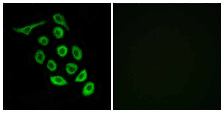 RPS12 / Ribosomal Protein S12 Antibody - Immunofluorescence analysis of A549 cells, using RPS12 Antibody. The picture on the right is blocked with the synthesized peptide.