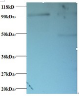 RPS12 / Ribosomal Protein S12 Antibody - Western blot of 40S ribosomal protein S12 antibody at 2 ug/ml. Lane 1: EC109 whole cell lysate. Lane 2: 293T whole cell lysate. Secondary: Goat polyclonal to Rabbit IgG at 1:15000 dilution. Predicted band size: 14.5 kDa. Observed band size: 90 kDa Additional bands at: 50 kDa. We are unsure as to the identity of this extra band.  This image was taken for the unconjugated form of this product. Other forms have not been tested.