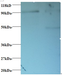 RPS12 / Ribosomal Protein S12 Antibody - Western blot of 40S ribosomal protein S12 antibody at 2 ug/ml. Lane 1: EC109 whole cell lysate. Lane 2: 293T whole cell lysate. Secondary: Goat polyclonal to Rabbit IgG at 1:15000 dilution. Predicted band size: 14.5 kDa. Observed band size: 90 kDa Additional bands at: 50 kDa. We are unsure as to the identity of this extra band.  This image was taken for the unconjugated form of this product. Other forms have not been tested.
