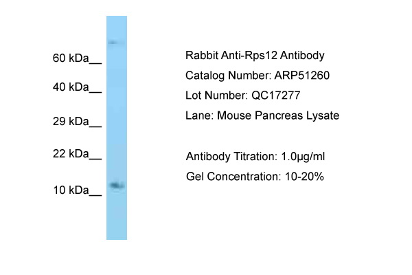 RPS12 / Ribosomal Protein S12 Antibody -  This image was taken for the unconjugated form of this product. Other forms have not been tested.