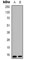 RPS12 / Ribosomal Protein S12 Antibody - Western blot analysis of RPS12 expression in HeLa (A); MCF7 (B) whole cell lysates.
