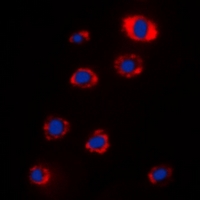 RPS12 / Ribosomal Protein S12 Antibody - Immunofluorescent analysis of RPS12 staining in HeLa cells. Formalin-fixed cells were permeabilized with 0.1% Triton X-100 in TBS for 5-10 minutes and blocked with 3% BSA-PBS for 30 minutes at room temperature. Cells were probed with the primary antibody in 3% BSA-PBS and incubated overnight at 4 deg C in a humidified chamber. Cells were washed with PBST and incubated with a DyLight 594-conjugated secondary antibody (red) in PBS at room temperature in the dark. DAPI was used to stain the cell nuclei (blue).