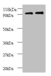RPS12 / Ribosomal Protein S12 Antibody - Western blot All lanes: 40S ribosomal protein S12 antibody at 2µg/ml Lane 1: EC109 whole cell lysate Lane 2: 293T whole cell lysate Secondary Goat polyclonal to rabbit IgG at 1/15000 dilution Predicted band size: 14.5 kDa Observed band size: 90 kDa