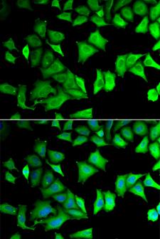 RPS12 / Ribosomal Protein S12 Antibody - Immunofluorescence analysis of MCF-7 cells.