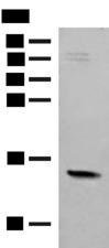 RPS12 / Ribosomal Protein S12 Antibody - Western blot analysis of Mouse Pancreas tissue lysate  using RPS12 Polyclonal Antibody at dilution of 1:500
