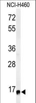 RPS13 / Ribosomal Protein S13 Antibody - Western blot of RPS13 Antibody in NCI-H460 cell line lysates (35 ug/lane). RPS13 (arrow) was detected using the purified antibody.