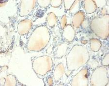 RPS13 / Ribosomal Protein S13 Antibody - Immunohistochemistry of paraffin-embedded human thyroid tissue using RPS13 Antibody at dilution of 1:100