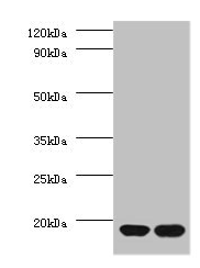 RPS13 / Ribosomal Protein S13 Antibody - Western blot All lanes: 40S ribosomal protein S13 antibody at 2µg/ml Lane 1: EC109 whole cell lysate Lane 2: 293T whole cell lysate Secondary Goat polyclonal to rabbit IgG at 1/15000 dilution Predicted band size: 17 kDa Observed band size: 17 kDa