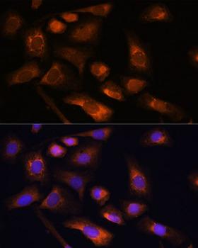 RPS13 / Ribosomal Protein S13 Antibody - Immunofluorescence analysis of U-2OS cells using RPS13 Polyclonal Antibody at dilution of 1:100.Blue: DAPI for nuclear staining.