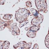 RPS13 / Ribosomal Protein S13 Antibody - Immunohistochemistry of paraffin-embedded Human placenta using RPS13 Polyclonal Antibody at dilution of 1:100 (40x lens).