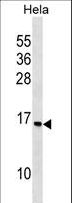 RPS14 / Ribosomal Protein S14 Antibody - RPS14 Antibody western blot of HeLa cell line lysates (35 ug/lane). The RPS14 antibody detected the RPS14 protein (arrow).