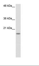 RPS14 / Ribosomal Protein S14 Antibody - HepG2 Cell Lysate.  This image was taken for the unconjugated form of this product. Other forms have not been tested.