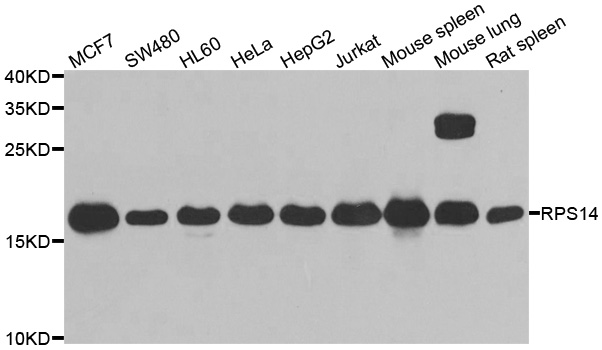 RPS14 / Ribosomal Protein S14 Antibody - Western blot analysis of extracts of various cell lines.
