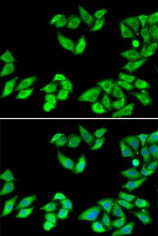RPS14 / Ribosomal Protein S14 Antibody - Immunofluorescence analysis of MCF7 cells.