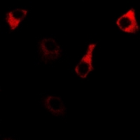 RPS14 / Ribosomal Protein S14 Antibody - Immunofluorescent analysis of RPS14 staining in MCF7 cells. Formalin-fixed cells were permeabilized with 0.1% Triton X-100 in TBS for 5-10 minutes and blocked with 3% BSA-PBS for 30 minutes at room temperature. Cells were probed with the primary antibody in 3% BSA-PBS and incubated overnight at 4 deg C in a humidified chamber. Cells were washed with PBST and incubated with a DyLight 594-conjugated secondary antibody (red) in PBS at room temperature in the dark.