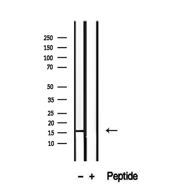 RPS14 / Ribosomal Protein S14 Antibody - Western blot analysis of extracts of mouse liver tissue using RPS14 antibody.