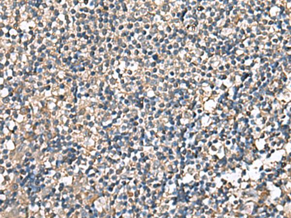 RPS14 / Ribosomal Protein S14 Antibody - Immunohistochemistry of paraffin-embedded Human tonsil tissue  using RPS14 Polyclonal Antibody at dilution of 1:60(×200)