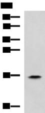 RPS14 / Ribosomal Protein S14 Antibody - Western blot analysis of HL60 cell lysate  using RPS14 Polyclonal Antibody at dilution of 1:900