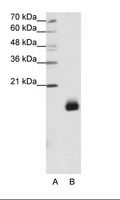 RPS14 / Ribosomal Protein S14 Antibody - A: Marker, B: Jurkat Cell Lysate.  This image was taken for the unconjugated form of this product. Other forms have not been tested.