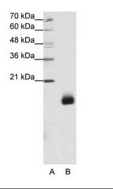 RPS14 / Ribosomal Protein S14 Antibody - A: Marker, B: Jurkat Cell Lysate.  This image was taken for the unconjugated form of this product. Other forms have not been tested.
