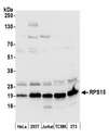 RPS15 / Ribosomal Protein S15 Antibody - Detection of human and mouse RPS15 by western blot. Samples: Whole cell lysate (50 µg) from HeLa, HEK293T, Jurkat, mouse TCMK-1, and mouse NIH 3T3 cells prepared using NETN lysis buffer. Antibody: Affinity purified rabbit anti-RPS15 antibody used for WB at 0.1 µg/ml. Detection: Chemiluminescence with an exposure time of 10 seconds.
