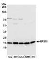 RPS15 / Ribosomal Protein S15 Antibody - Detection of human and mouse RPS15 by western blot. Samples: Whole cell lysate (50 µg) from HeLa, HEK293T, Jurkat, mouse TCMK-1, and mouse NIH 3T3 cells prepared using NETN lysis buffer. Antibody: Affinity purified rabbit anti-RPS15 antibody used for WB at 0.1 µg/ml. Detection: Chemiluminescence with an exposure time of 3 seconds.
