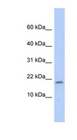 RPS15 / Ribosomal Protein S15 Antibody - RPS15 antibody Western blot of Fetal Liver lysate. This image was taken for the unconjugated form of this product. Other forms have not been tested.
