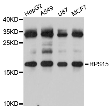 RPS15 / Ribosomal Protein S15 Antibody - Western blot analysis of extracts of various cell lines.