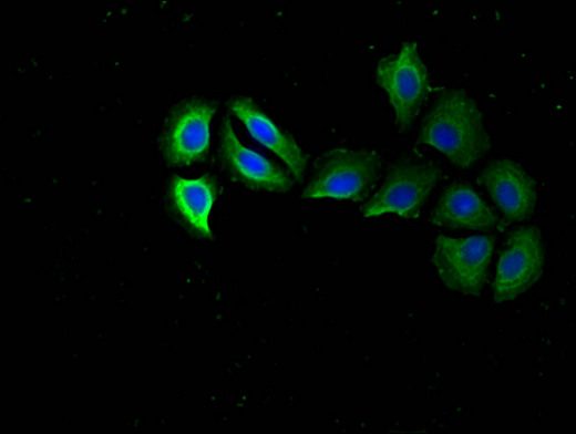RPS15 / Ribosomal Protein S15 Antibody - Immunofluorescent analysis of A549 cells using RPS15 Antibody at a dilution of 1:100 and Alexa Fluor 488-congugated AffiniPure Goat Anti-Rabbit IgG(H+L)