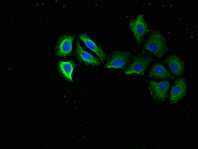 RPS15 / Ribosomal Protein S15 Antibody - Immunofluorescent analysis of A549 cells using RPS15 Antibody at dilution of 1:100 and Alexa Fluor 488-congugated AffiniPure Goat Anti-Rabbit IgG(H+L)