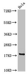 RPS15 / Ribosomal Protein S15 Antibody - Western Blot Positive WB detected in: Hela whole cell lysate All lanes: RPS15 antibody at 4µg/ml Secondary Goat polyclonal to rabbit IgG at 1/50000 dilution Predicted band size: 18 kDa Observed band size: 18 kDa