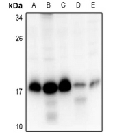 RPS15 / Ribosomal Protein S15 Antibody - Western blot analysis of RPS15 expression in SKOVCAR3 (A), HEK293T (B), A549 (C), AML12 (D), PC12 (E) whole cell lysates.