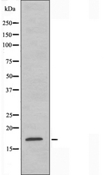 RPS15 / Ribosomal Protein S15 Antibody - Western blot analysis of extracts of Jurkat cells using RPS15 antibody.
