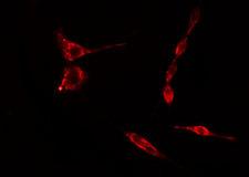RPS15 / Ribosomal Protein S15 Antibody - Staining HeLa cells by IF/ICC. The samples were fixed with PFA and permeabilized in 0.1% Triton X-100, then blocked in 10% serum for 45 min at 25°C. The primary antibody was diluted at 1:200 and incubated with the sample for 1 hour at 37°C. An Alexa Fluor 594 conjugated goat anti-rabbit IgG (H+L) antibody, diluted at 1/600, was used as secondary antibody.