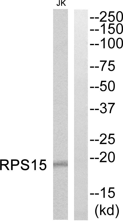 RPS15 / Ribosomal Protein S15 Antibody - Western blot analysis of extracts from Jurkat cells, using RPS15 antibody.