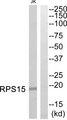 RPS15 / Ribosomal Protein S15 Antibody - Western blot analysis of extracts from Jurkat cells, using RPS15 antibody.