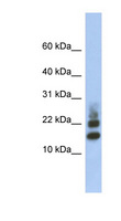 RPS15A Antibody - RPS15A antibody Western blot of Fetal Muscle lysate. This image was taken for the unconjugated form of this product. Other forms have not been tested.