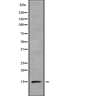 RPS15A Antibody - Western blot analysis of RPS15A using LOVO cells whole cells lysates