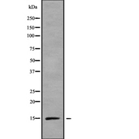 RPS15A Antibody - Western blot analysis of RPS15A using LOVO cells whole cells lysates